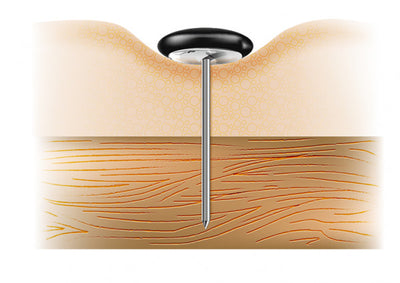 Spijkerknopen Astor P28 spijker 25 mm 1000 st